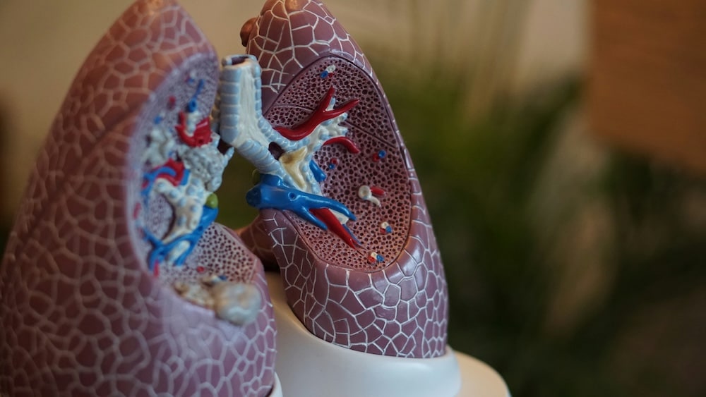 Cáncer de pulmón: Un panorama general