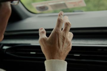 Artritis Reumatoide: Desafíos Actuales para un Diagnóstico Certero