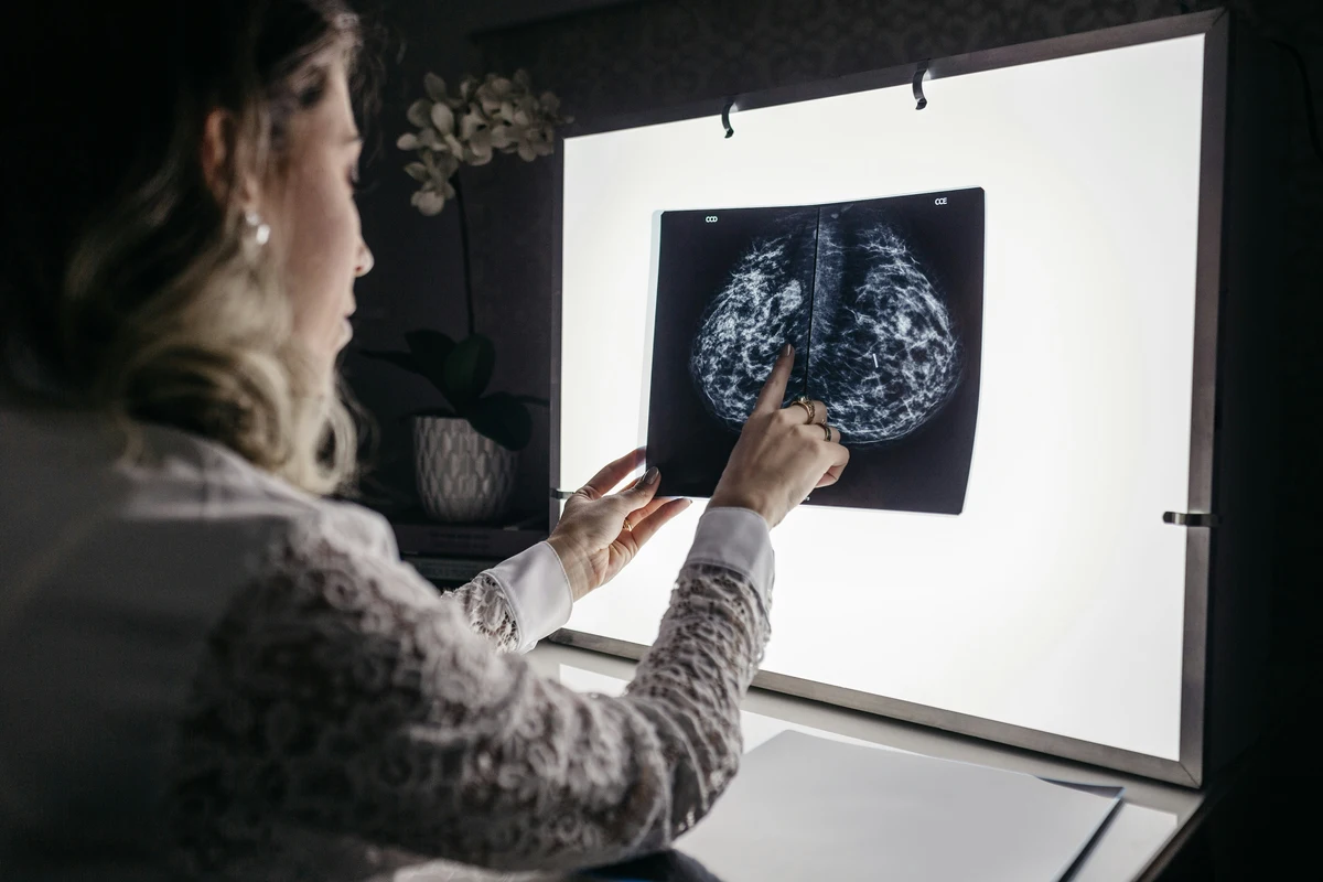Avances que están cambiando el panorama del cáncer de mama